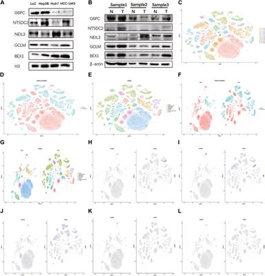 Single-cell and genetic multi-omics analysis combined with experiments confirmed the signature and potential targets of cuproptosis in hepatocellular carcinoma